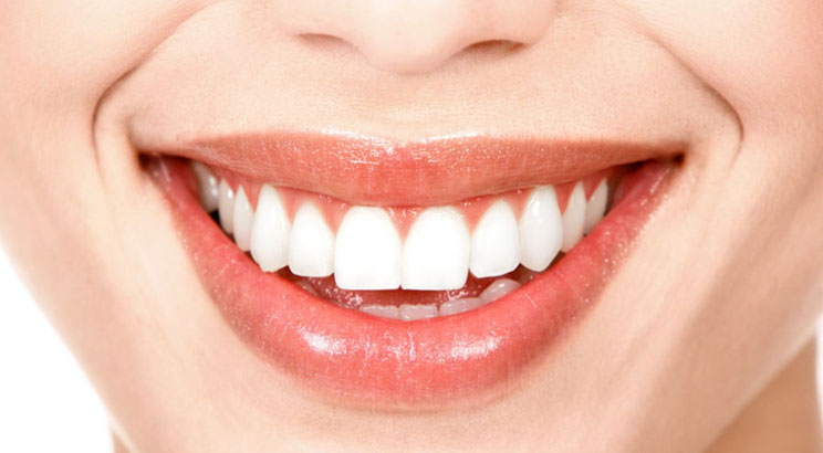 Ofis Tipi Diş Beyazlatma Nedir, Ev Tipi Beyazlatmaya Göre Nasıl Bir Farkı Var?