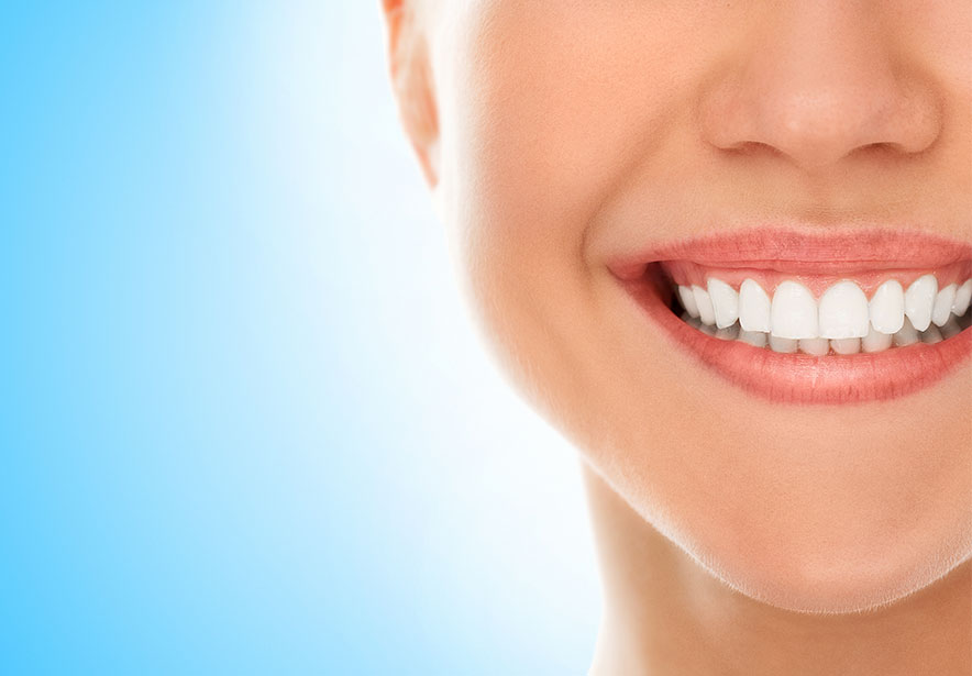 Diş Beyazlatma İle İlgili Bilinen 5 Yanlış